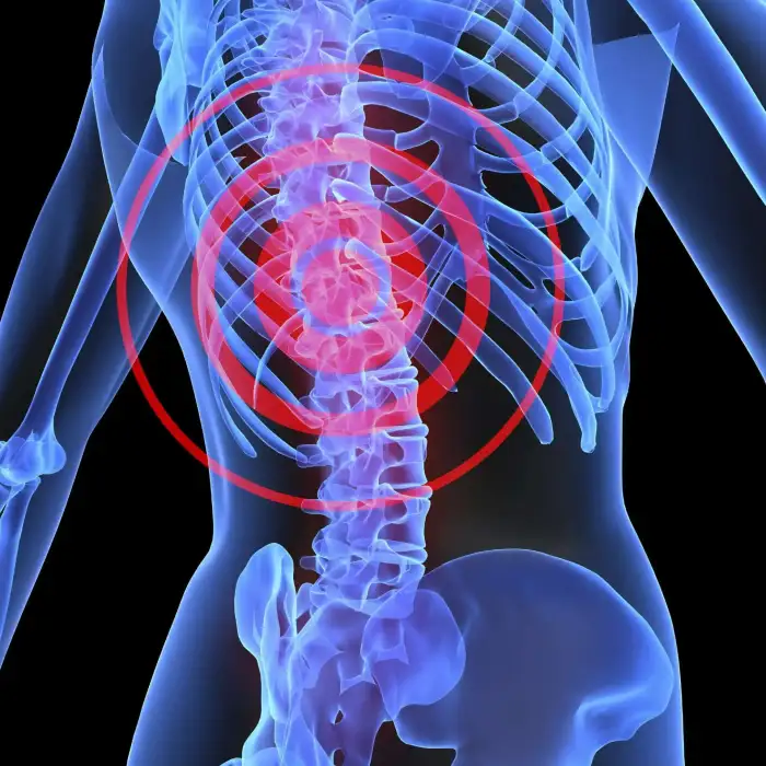 Sportif Omurga Yaralanmaları